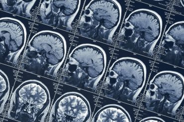 Neuroscientists shed new light on how heroin disrupts prefrontal brain function