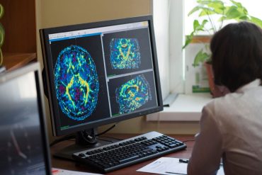 Frequent egg consumption linked to lower risk of Alzheimer’s dementia, study finds