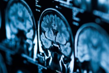 Cognitive tests suggest psilocybin impairs thinking—but the tests may not tell the full story