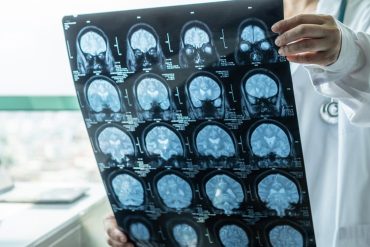 A common vegetable may counteract brain changes linked to obesity